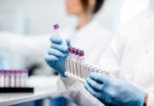 Johnson & Johnson ทุ่ม 3.2 หมื่นล้านบาท พัฒนาวัคซีน COVID-19 หวังใช้ได้จริงต้นปี 2021