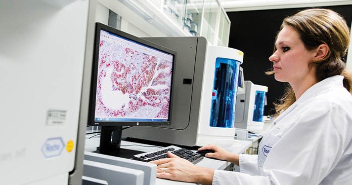 โรชเปิดตัวโซลูชั่นตรวจหาแอนติเจน (สารก่อภูมิต้านทาน) ต่อเชื้อซาร์ส-โควี-ทู เพื่อห้องปฏิบัติการ สามารถรองรับการตรวจผู้ป่วยเสี่ยงโรคโควิด-19 ปริมาณมาก